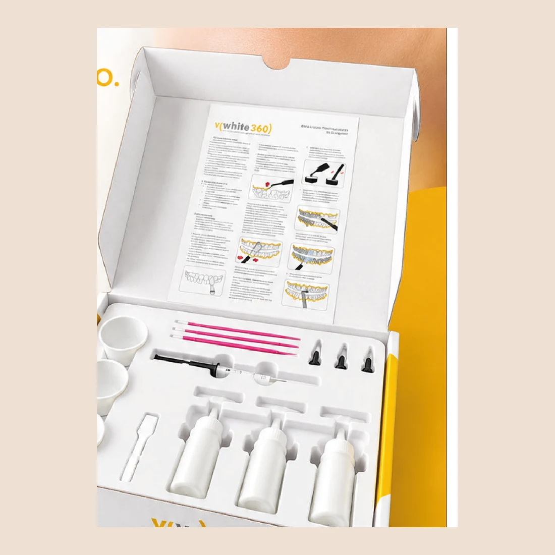 Kit professionale per sbiancamento aperto, con vasetti, siringhe, flaconi, spatola e pennellini.